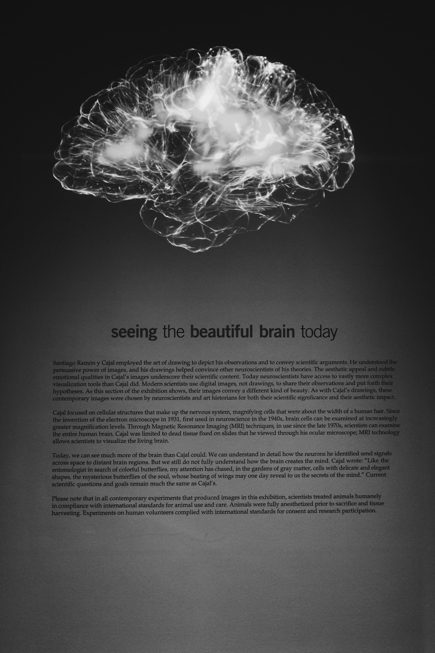 Understanding EEG Insights for a Healthier Mind